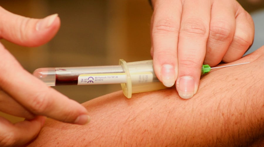 Bild: ACP/PRP Therapie